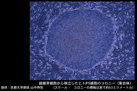 「iPS細胞がひらく未来週間（6月13日～18日）」を日本科学未来館で開催